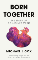 book cover for Born Together: The Story of Conjoined Twins